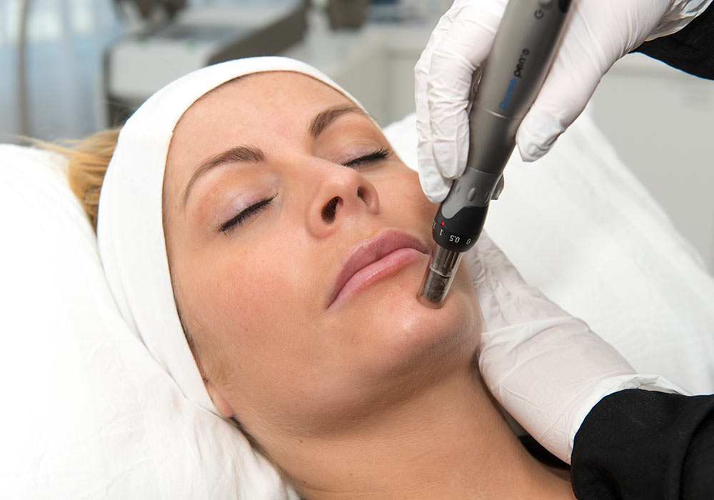 Dermapen (micro needling) Oslo Dermapen (micro needling) Oslo