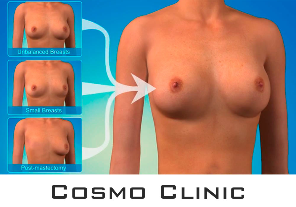 Brystforstørring pasientoversikt Brystforstørring pasientoversikt