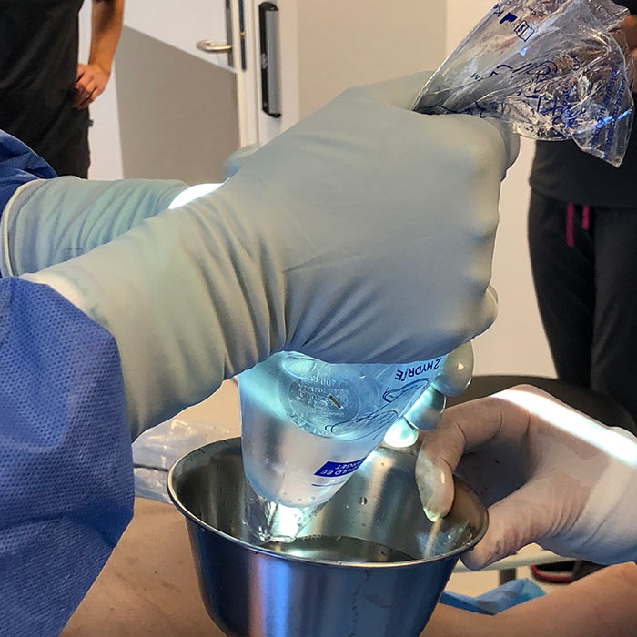 Keller funnel til Motiva silikonprotese for brystforstørring Keller funnel til Motiva silikonprotese for brystforstørring