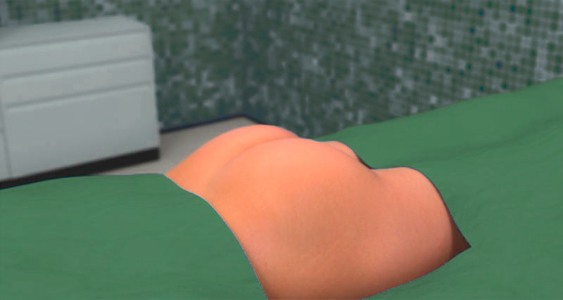 Seteløft / seteplastikk Seteløft -rumpeløft - seteplastikk