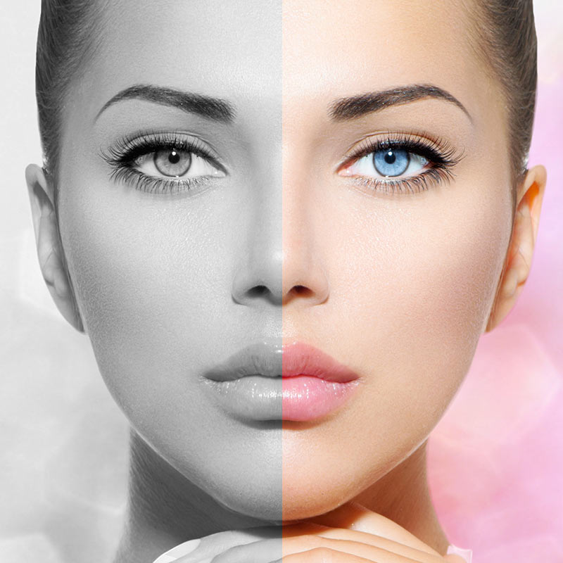 Før etter bilde ansiktsløft