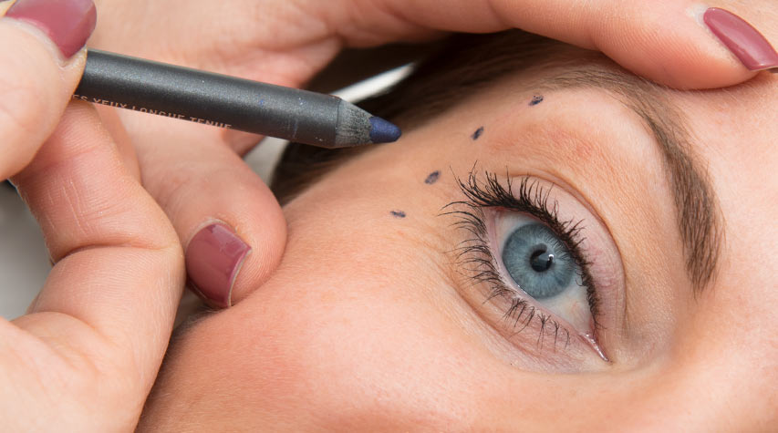 Smilerynker Smilerynker