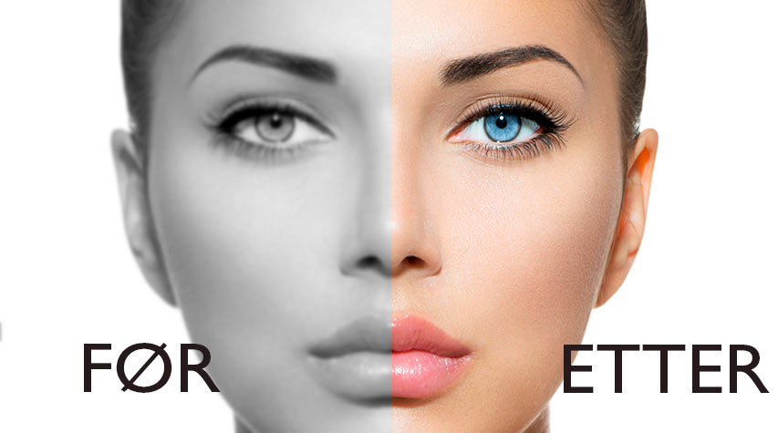 før-etter-bilder poser under oynene