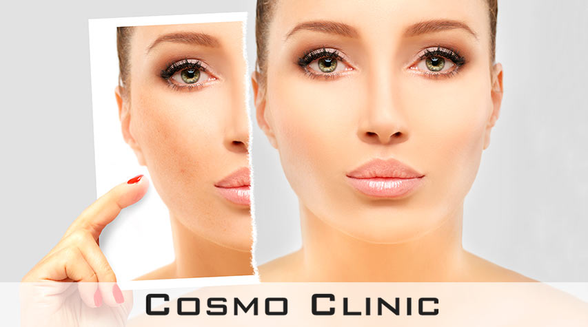 Pigmentflekker ansikt