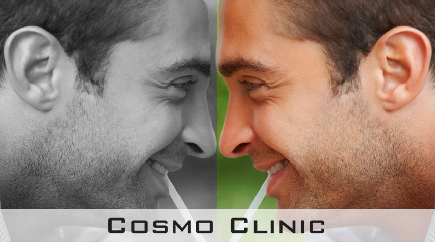 Plastisk kirurgi menn neseoperasjon